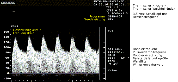 Parameter